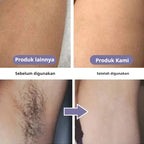 Portable Electric Hair Remover – USB Charging, Skin-Friendly Design